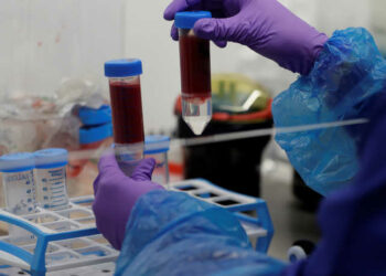 دراسة توضح زمرة الدم الأقل عرضة للإصابة بكورونا