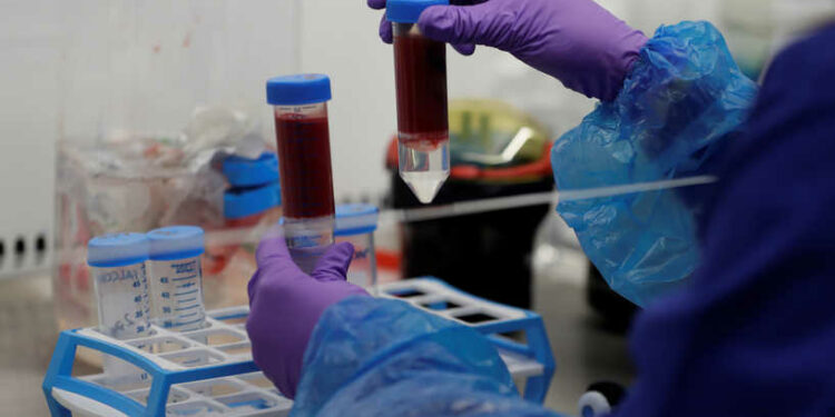 دراسة توضح زمرة الدم الأقل عرضة للإصابة بكورونا