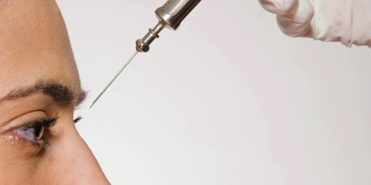 فيلر الأنف: الحل الغير جراحي لتحسين مظهر الأنف