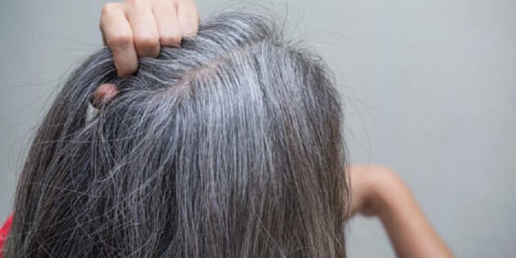 الشيب المبكر: الأسباب والعوامل المؤثرة