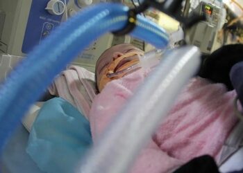 وكالة أونروا: الرضع في غزة يموتون ببطء أمام أنظار العالم