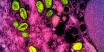 يونيسف تطرح مناقصة طارئة لتأمين لقاحات جدري القردة