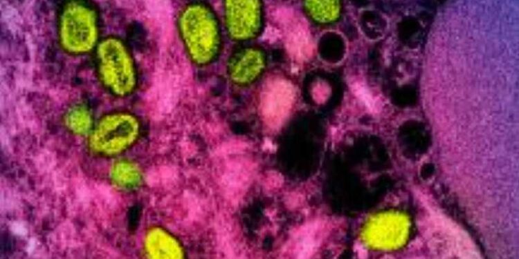 يونيسف تطرح مناقصة طارئة لتأمين لقاحات جدري القردة