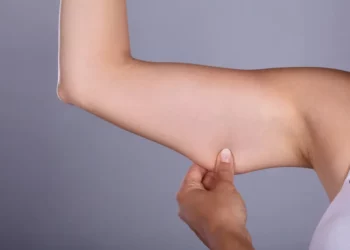 كل ما تحتاجين معرفته عن عملية شد الذراعين