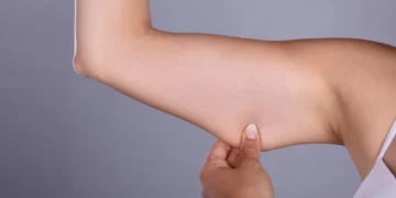 كل ما تحتاجين معرفته عن عملية شد الذراعين
