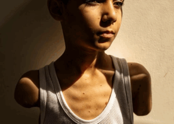 من بين 60 ألفا.. صورة طفل فلسطيني مصاب تفوز بجائزة “صورة العام”