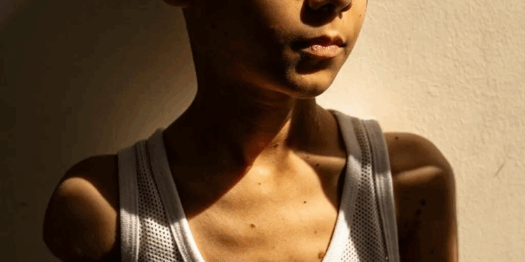 من بين 60 ألفا.. صورة طفل فلسطيني مصاب تفوز بجائزة “صورة العام”