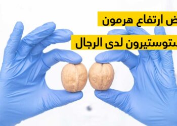 4 علامات تشير إلى زيادة مستويات هرمون التستوستيرون