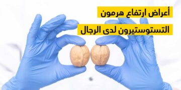 4 علامات تشير إلى زيادة مستويات هرمون التستوستيرون