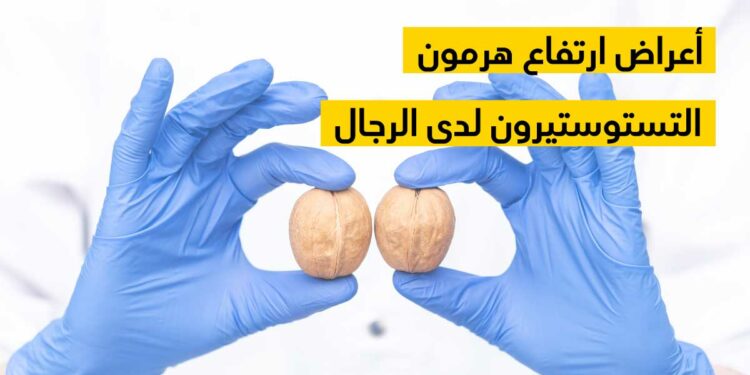 4 علامات تشير إلى زيادة مستويات هرمون التستوستيرون