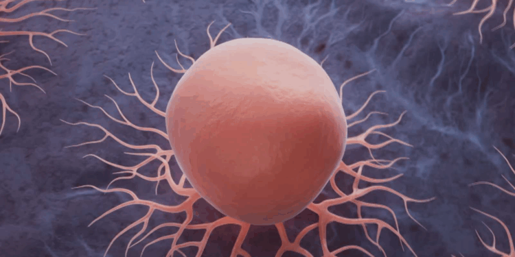 اختبار دم “ثوري” يكشف السرطان قبل 10 سنوات من ظهوره