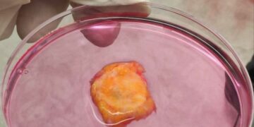 مركز أبوظبي للخلايا الجذعية يطلق علاجا مبتكرا للسرطان