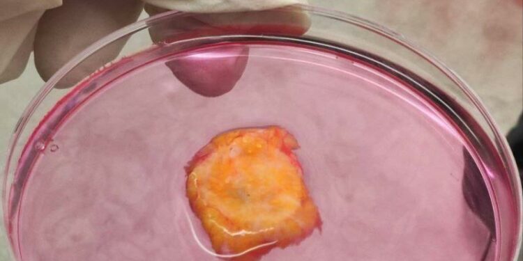 مركز أبوظبي للخلايا الجذعية يطلق علاجا مبتكرا للسرطان