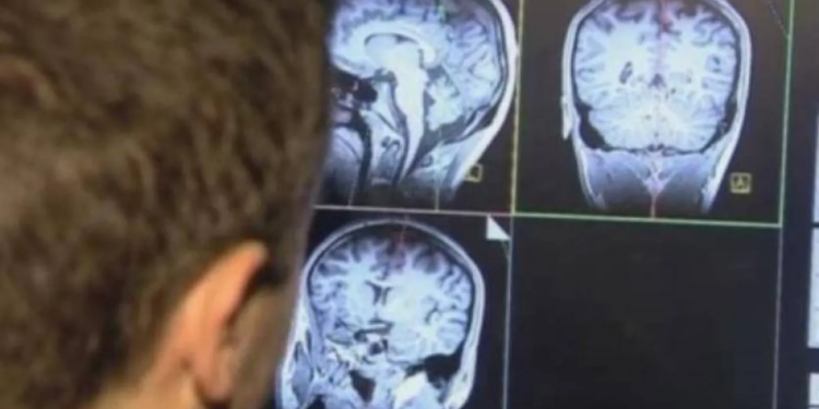 فيتامين يبطئ تقدم أحد أخطر أنواع سرطان الدماغ